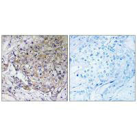 WASF3 Antibody