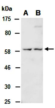 WASF3 antibody