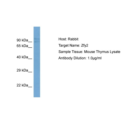 Zfy2 antibody