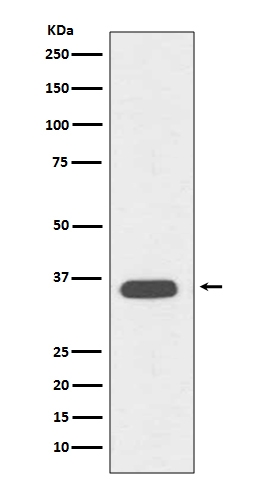 CD68/Sr D1 Rabbit Monoclonal Antibody