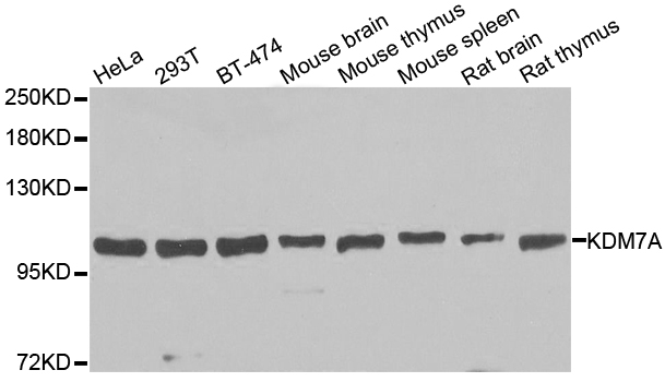 KDM7A antibody