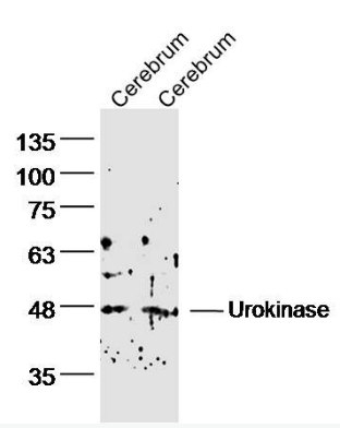 uPA antibody
