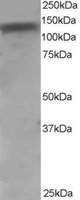 Goat anti-ADAM17 / TACE Antibody
