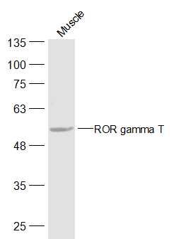ROR Gamma T antibody