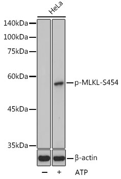 MLKL (Phospho-S454) antibody