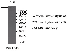 Anti-ALMS1