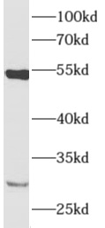 AMIGO3 antibody