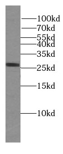WBS15 antibody