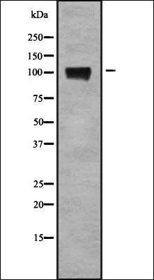 WBSCR11 antibody