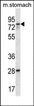 WBSCR17 antibody