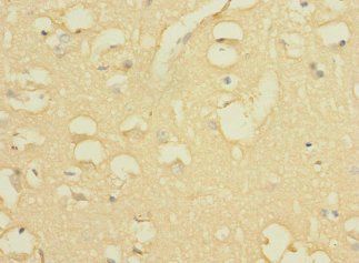 GALNT17 Antibody
