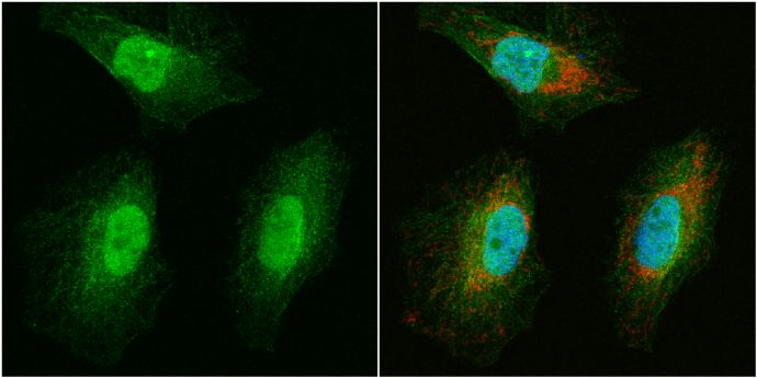 WBSCR22 Rabbit Polyclonal Antibody