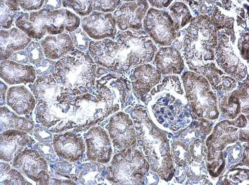 WBSCR22 Rabbit Polyclonal Antibody