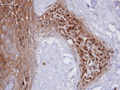 WBSCR22 Rabbit Polyclonal Antibody