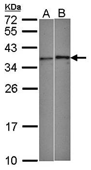 WBSCR22 antibody