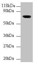 WD repeat-containing and planar cell polarity effector protein fritz homolog antibody