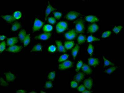 WDFY2 Antibody