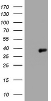 WDFY3 antibody