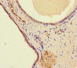 WDFY4 Antibody