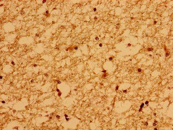 WDPCP Antibody
