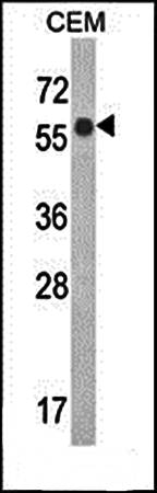 WDR1 antibody