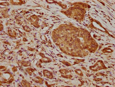 WDR35 Antibody