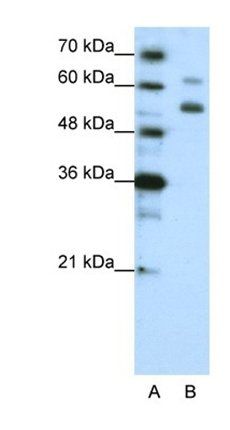 WDR4 antibody