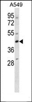WDR45 antibody