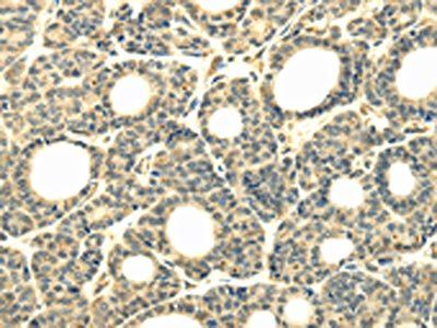 WDR45B Antibody