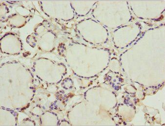 WDR47 Antibody