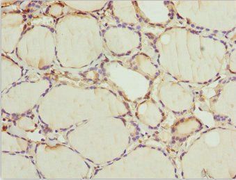 WDR47 Antibody