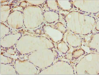 WDR47 antibody