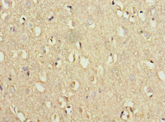 WDR60 Antibody
