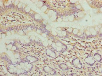WDR66 Antibody