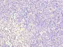 WDR74 Antibody