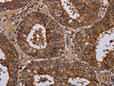 WDR83 Antibody