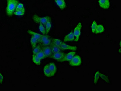 WDR83 antibody