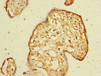 WDR88 Antibody