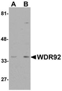 WDR92 Antibody