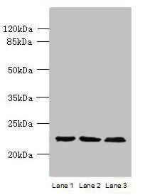 WDYHV1 antibody