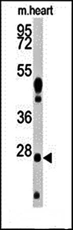 WDYHV1 antibody