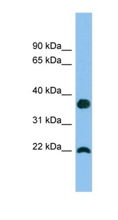 WFDC1 antibody