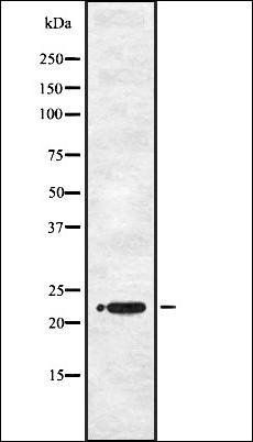 WFDC2 antibody