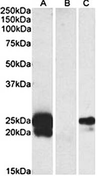 Goat anti-WFDC2 (aa29-43) Antibody