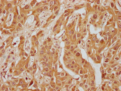 WFIKKN1 Antibody