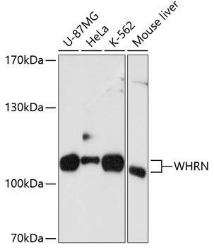 WHRN antibody