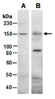 WHSC1 (M) Antibody, Rabbit Polyclonal