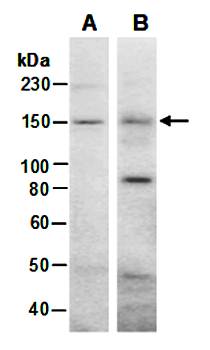 WHSC1 (N) Antibody, Rabbit Polyclonal
