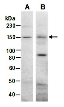 WHSC1 antibody