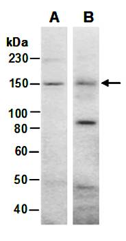 WHSC1 (vPairTM) Antibodies